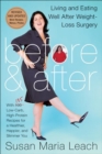 Image for Before &amp; After: Living and Eating Well After Weight-loss Surgery