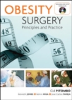 Image for Obesity Surgery: Principles and Practice