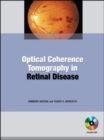 Image for Optical Coherence Tomography in Retinal Disease