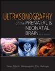 Image for Ultrasonography of the prenatal and neonatal brain.
