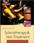 Image for Sclerotherapy and vein treatment