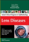 Image for Lens Diseases