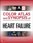 Image for Color Atlas and Synopsis of Heart Failure