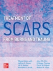 Image for Treatment of Scars from Burns and Trauma