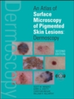 Image for An Atlas of Surface Microscopy of Pigmented Skin Lesions