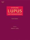 Image for Systemic Lupus Erythematosus
