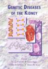 Image for Genetic diseases of the kidney