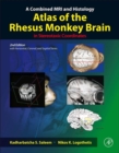 Image for A combined MRI and histology atlas of the rhesus monkey brain in stereotaxic coordinates