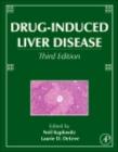 Image for Drug-induced liver disease