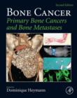 Image for Bone cancer: primary bone cancers and bone metastases