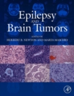 Image for Epilepsy and brain tumors