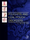 Image for Pouchitis and Ileal Pouch Disorders : A Multidisciplinary Approach for Diagnosis and Management