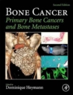 Image for Bone Cancer