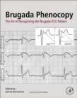 Image for Brugada phenocopy  : the art of recognizing the Brugada ECG pattern