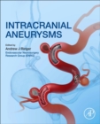 Image for Intracranial Aneurysms