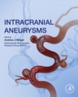 Image for Intracranial aneurysms