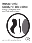 Image for Intracranial epidural bleeding: history, management, and pathophysiology