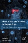 Image for Stem Cells and Cancer in Hepatology