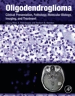 Image for Oligodendroglioma: clinical presentation, pathology, molecular biology, imaging, and treatment