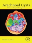 Image for Arachnoid cysts: epidemiology, biology, and neuroimaging