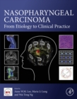 Image for Nasopharyngeal Carcinoma: From Etiology to Clinical Practice