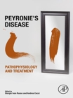 Image for Peyronie&#39;s Disease: Pathophysiology and Treatment