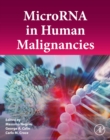 Image for MicroRNA in Human Malignancies