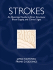 Image for Strokes : An Illustrated Guide to Brain Structure, Blood Supply and Clinical Signs