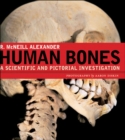 Image for Human Bones