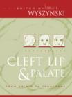 Image for Cleft lip and palate: from origin to treatment
