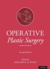 Image for Operative Plastic Surgery