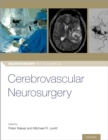 Image for Cerebrovascular Neurosurgery