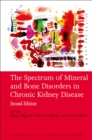 Image for The spectrum of mineral and bone disorders in chronic kidney disease