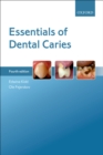 Image for Essentials of dental caries.