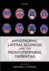 Image for Amyotrophic lateral sclerosis and the frontotemporal dementias