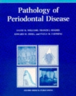 Image for Pathology of Periodontal Disease