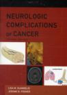 Image for Neurologic complications of cancer