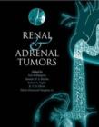 Image for Renal and adrenal tumors  : biology and management
