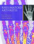 Image for Rheumatoid arthritis