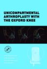 Image for Unicompartmental arthroplasty with the Oxford knee