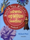 Image for Would You Believe....Cobwebs Stop Wounds Bleeding?