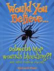 Image for Would you believe cobwebs stop wounds bleeding? and other medical marvels