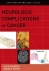 Image for Neurologic complications of cancer