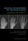 Image for Skeletal Development of the Hand and Wrist Digital Bone Age Companion