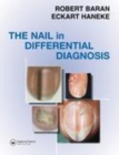 Image for Nail in differential diagnosis