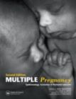 Image for Multiple pregnancy: epidemiology, gestation &amp; perinatal outcome