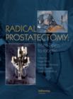 Image for Radical prostatectomy: from open to robotic