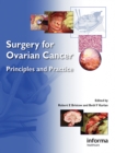 Image for Surgery for ovarian cancer: principles and practice