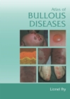 Image for Atlas of bullous diseases