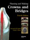 Image for Planning and making crowns and bridges.
